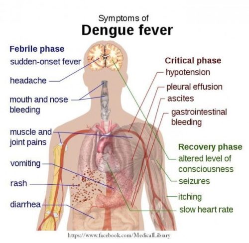 denquefever