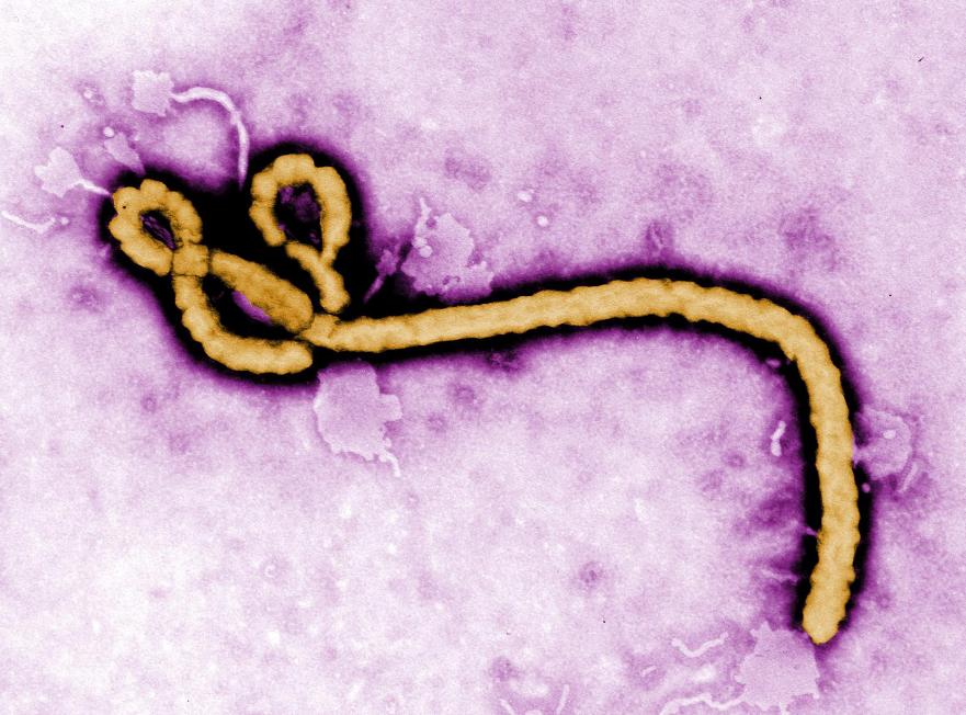 first case of ebola in pakistan fake rumor