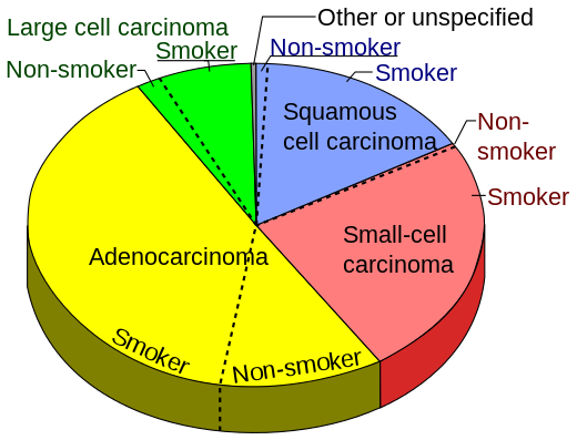 incidence of small cell lung carcinoma