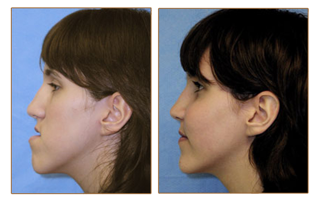 Can you take diet pills at 14 image 9