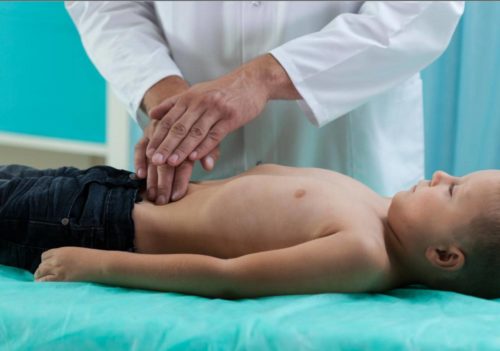 rovsings-sign-appendicitis_2