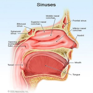 sinus infection